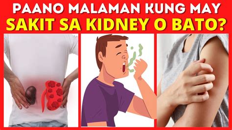 iba't ibang uri ng bato|17 na sintomas ng sakit sa bato o kidney stones at iba .
